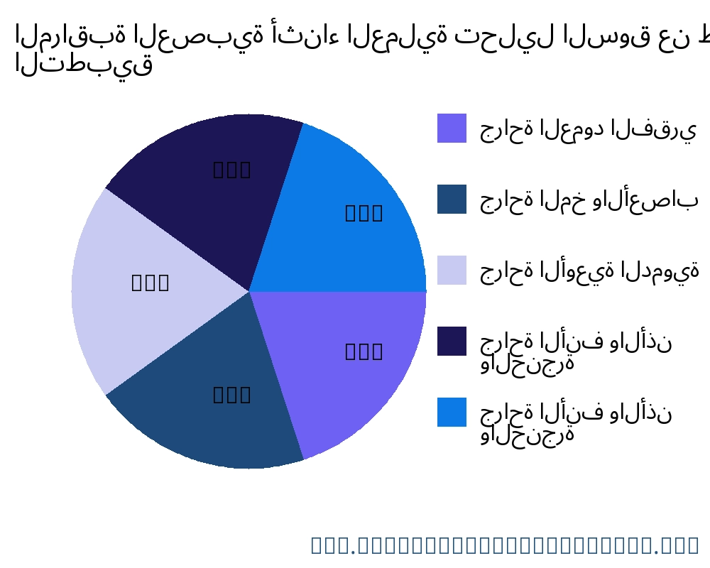 المراقبة العصبية أثناء العملية السوق حسب التطبيق - Infinitive Data Research